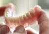 Proteze dentare sau implant dentar? Alegerea tratamentului corect