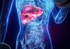 Wegovy® a redus grăsimea din ficat la valori normale la aproape 9 din 10 participanți cu obezitate și steatoză, într-o analiză prezentată la EASD 2026